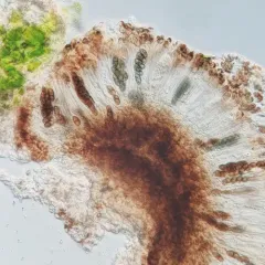 Tiny Button Lichen thumbnail 1