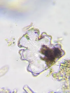 Euastrum oblongum thumbnail 2