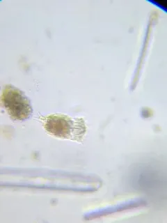 Cephalodella auriculata thumbnail 4