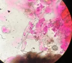 Botryobasidium capitatum thumbnail 4