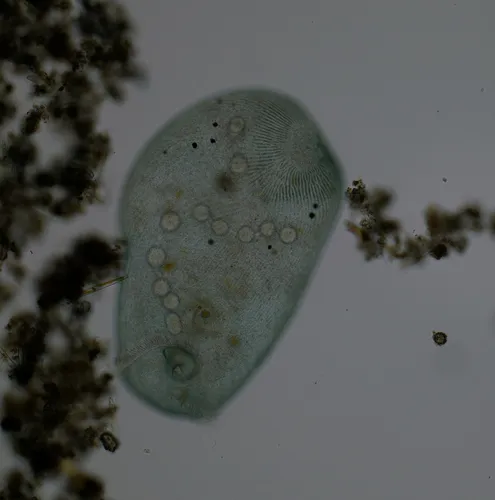 Stentor coeruleus