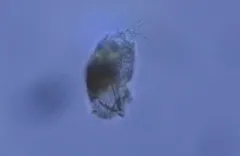 Cephalodella auriculata thumbnail 3