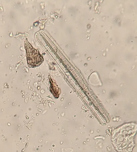 Epithemia gibba
