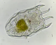 Keratella serrulata thumbnail 1