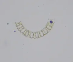 Eucampia zodiacus thumbnail 2