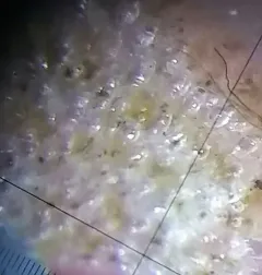 Celleporella hyalina thumbnail 2
