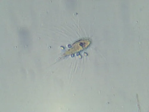 Mallomonas caudata