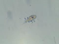 Mallomonas caudata thumbnail 1