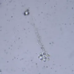 Anthophysa vegetans thumbnail 3