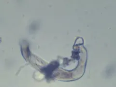 Spirostomum minus thumbnail 3