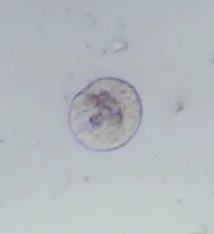 Entamoeba coli