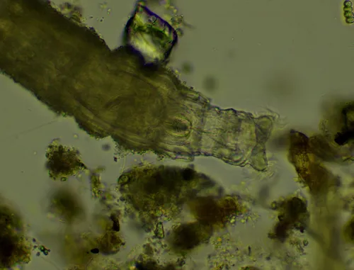 Dissotrocha macrostyla
