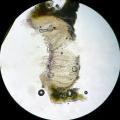Pertusaria rubefacta thumbnail 1