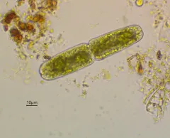Tetmemorus brebissonii thumbnail 4