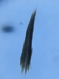 Aphanizomenon flosaquae thumbnail 2
