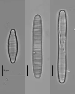 Diatoma vulgaris thumbnail 4