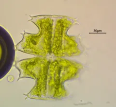 Micrasterias depauperata thumbnail 3