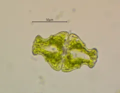 Euastrum ampullaceum thumbnail 2