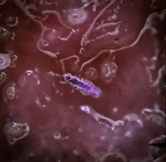 Lepidocyrtus fimicolus thumbnail 1