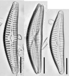 Cymbella hantzschiana thumbnail 1