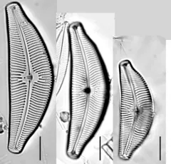 Cymbella tumida thumbnail 1