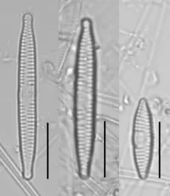 Fragilaria vaucheriae thumbnail 4