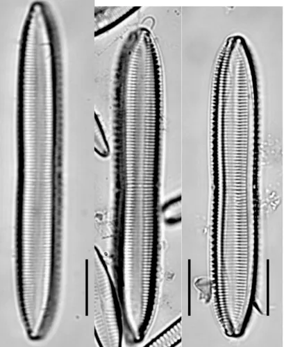Tryblionella hungarica
