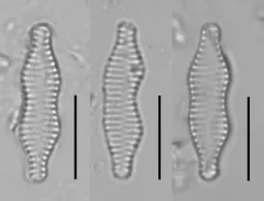 Staurosira binodis thumbnail 4