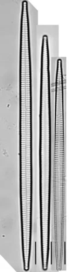 Ulnaria ulna thumbnail 4