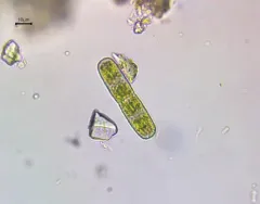 Penium margaritaceum thumbnail 1