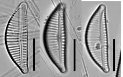 Encyonema lange-bertalotii thumbnail 2