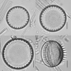 Stephanodiscus niagarae thumbnail 3