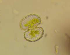 Cosmarium porteanum thumbnail 4