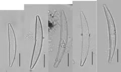 Fragilaria cyclopum thumbnail 2