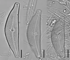 Cymbella tumida thumbnail 2