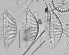 Encyonema lange-bertalotii thumbnail 3