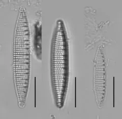 Nitzschia amphibia thumbnail 2