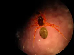 Walckenaeria cornuella thumbnail 2
