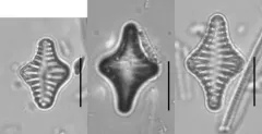 Staurosira leptostauron thumbnail 3