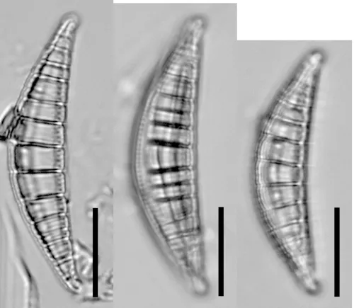 Epithemia gibberula