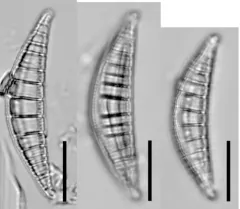 Epithemia gibberula thumbnail 1