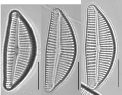 Encyonema auerswaldii thumbnail 1