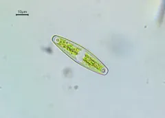 Closterium navicula thumbnail 2