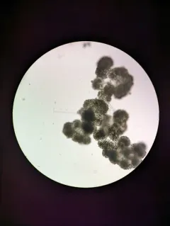 Dolichospermum lemmermannii thumbnail 4