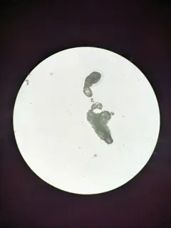 Microcystis aeruginosa thumbnail 3