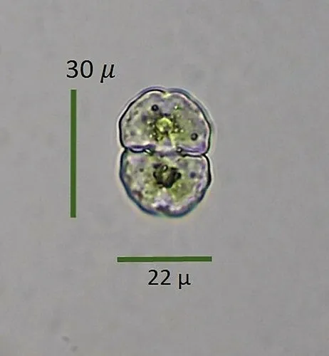 Cosmarium impressulum