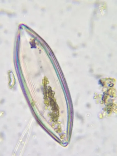 Neidium amphigomphus