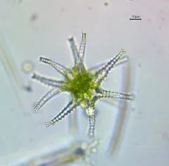 Staurastrum ophiura thumbnail 4