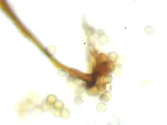 Stemonitis flavogenita thumbnail 4