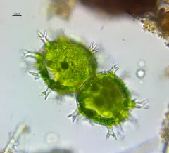 Xanthidium armatum thumbnail 4